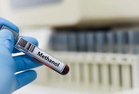 Blood sample tube for methanol test analysis.