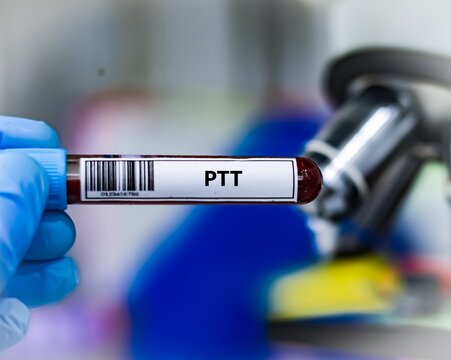 Blood sample tube for PTT test analysis.