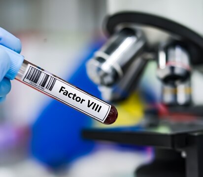 Blood sample tube for factor VIII test analysis.