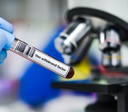 Blood sample tube for von willebrand factor test analysis.