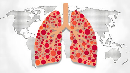 A global view of respiratory disease and lung health issues across the world