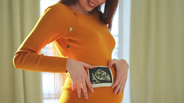Prenatal ultrasound screening. Pregnant woman holding sonogram picture of unborn baby inside her big belly. Happy expectant mom with fetus usi scan image. Young mother enjoying pregnancy. Maternity