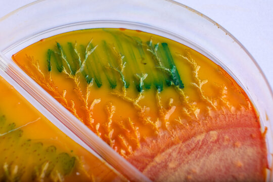 photo of bacteria and fungi growth on culture media in plastic plates