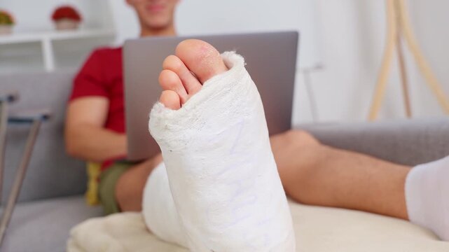 Man with broken leg cast working remotely from home couch