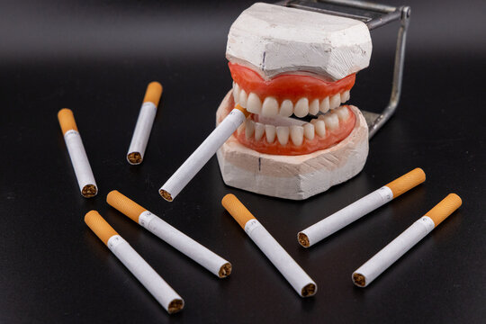 Dental model with dentures holding cigarette surrounded by many cigarettes on black background showing smoking risk, oral health problems, tooth loss, gum disease and cancer