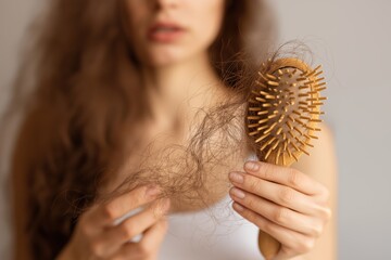 Woman Holding Hair Loss on Hairbrush &ndash; Hair Fall, Scalp Health and Beauty Problem Concept