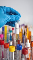 Hepatitis c test sample in laboratory
