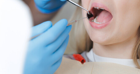 Caucasian female dental checkup with open mouth, doctor use equipment for professional oral caries...
