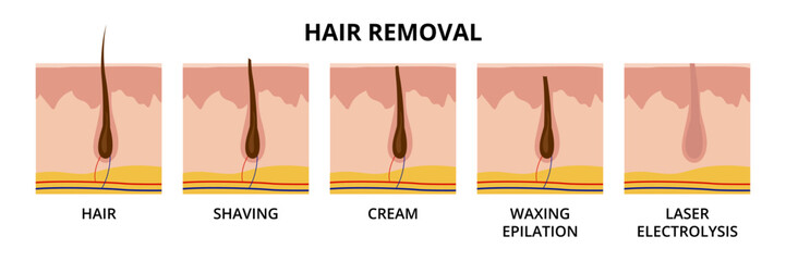 Hair removal methods. Hair, shaving, cream, waxing epilation, laser electrolysis
