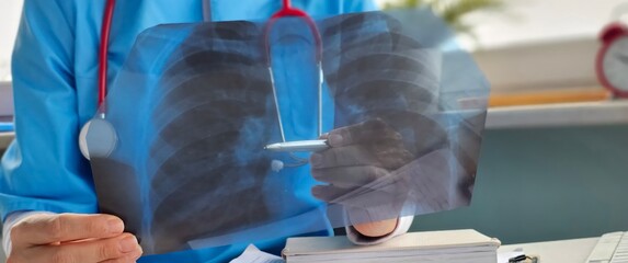 Doctor analyzes chest X-ray while consulting patient