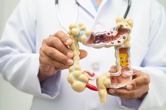 Intestine, doctor holding human anatomy model for study diagnosis and treatment in hospital.