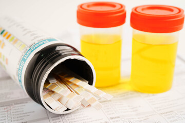 Urinalysis, urine cup with reagent strip pH paper test and comparison chart in laboratory.