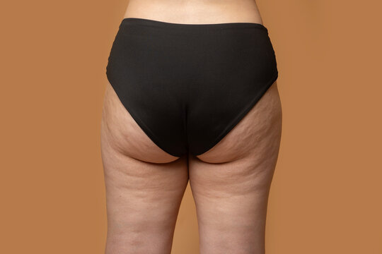 Woman with cellulite. Concept of weight loss and cellulite. Woman with cellulite on buttocks and legs. Cellulite on natural female skin.