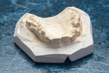 Impression of Dental Arch Model for Orthodontic Applications on Textured Surface © andrei310