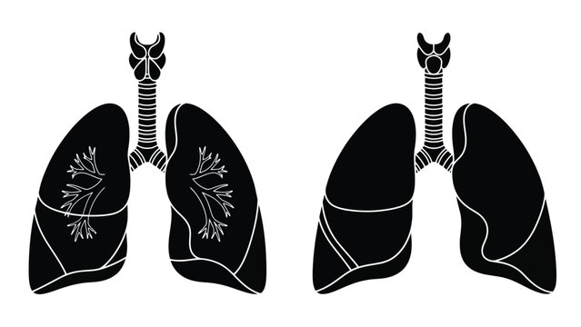 healthy lungs and lungs with pneumothorax condition