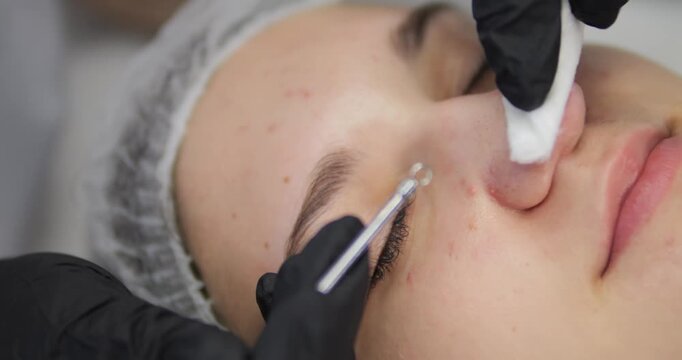 Cosmetic procedures for problematic facial skin in teenagers. Skin cleansing and acne removal.