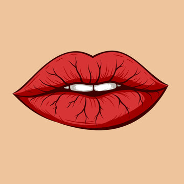 Dry Cracked Lips Cartoon Vector Illustration