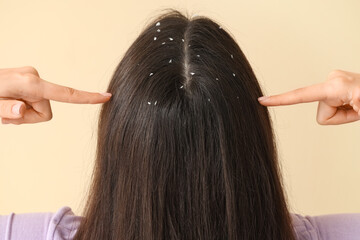 Fototapeta premium Young woman with dandruff problem pointing at flakes in her hair on beige background, back view