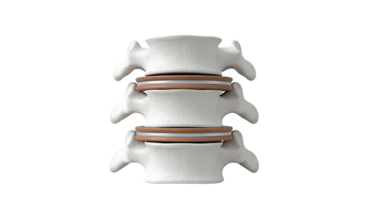 3D Rendering of Lumbar Vertebrae with Intervertebral Discs