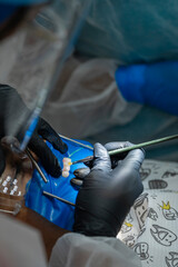 Vertical close-up of a dentist performing a precise restorative treatment on a patient