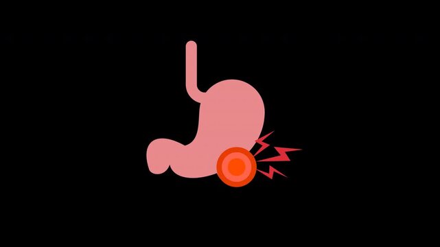 Abdominal Pain and Digestive Disorder Medical Concept Illustration