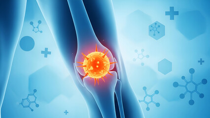 Orange virus particle infecting blue human knee joint with molecular graphics bone