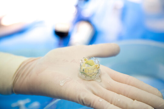 TAVI (Transcatheter Aortic Valve Implantation)