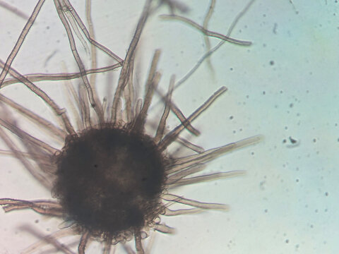 Microscopic View of Chaetomium Fungi Perithecia with Long Hairy Appe