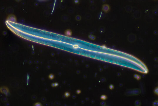 diatomea