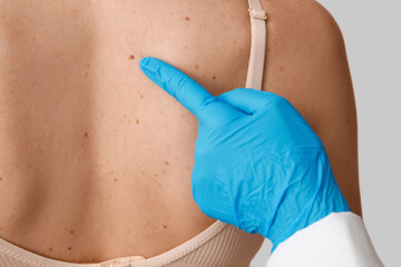 Dermatologist examining young woman with moles on pink background, closeup