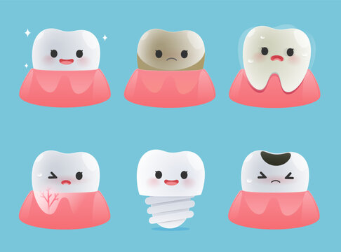 Cute dental cartoon set showing clean tooth, tartar, loose tooth, inflammation, implant, and decay encouraging regular checkups and better oral health habits. Illustrated oral health care concept.
