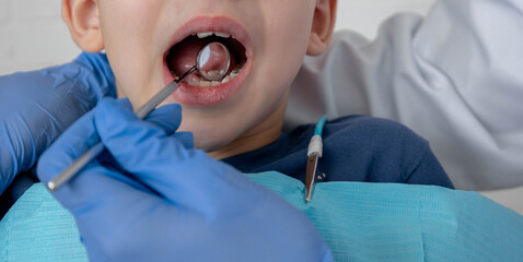 Dentist examining child's teeth with mirror, treatment process in pediatric clinic