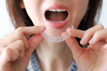 マウスピース矯正を装着する女性の口元