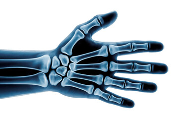 Hand skeleton x-ray isolated on transparent background