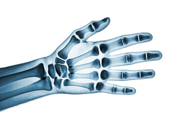 X-ray of human hand isolated on transparent background