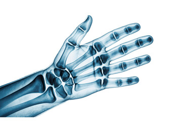 X-ray hand skeleton isolated on transparent background