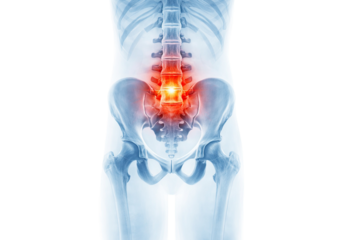 Lower back pain lumbar spine inflammation medical x-ray illustration of human pelvis and vertebrae isolated on white background