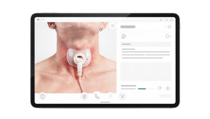 Splitscreen tablet interface featuring a live remote tracheostomy check with sidebyside views of patient stoma and medical notes on a clean white backdrop.