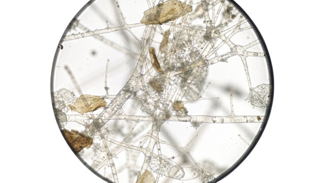 Closeup of fungal hyphae visible in skin flakes on a slide under a microscope isolated on white background for medical and educational use.