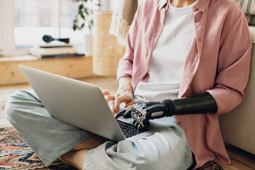Crop shot of robotic prosthesis hand of female working on laptop in living room , sitting on floor against window, dressed in casual clothes. Cybernetics, high technologies, bio-engineering