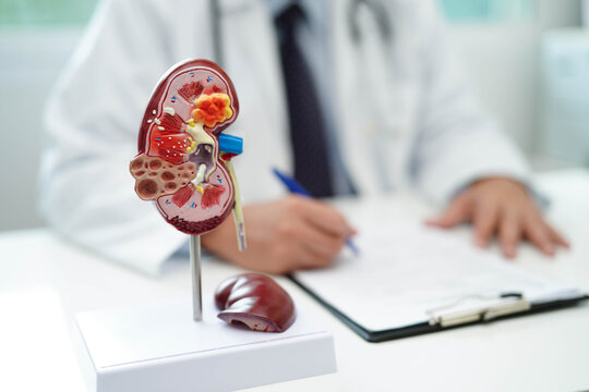 Chronic kidney disease, doctor with model for treatment urinary system, urology, Estimated glomerular filtration rate eGFR.