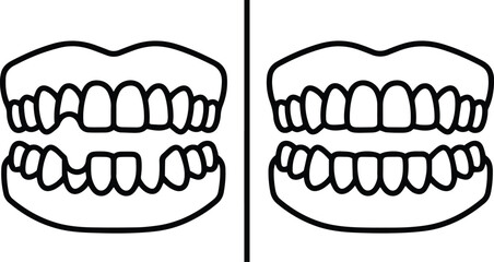 A Set of Missing Teeth alongside a Set of Full Human Teeth Icon in Outline Style