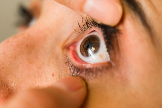 Doctor performing eye exam on patient, checking vision and health, with hands holding eyelid open