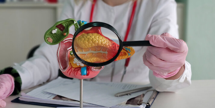 Anatomical model of the pancreas, duodenum, and spleen. Diseases and treatments for liver, spleen, and pancreas lesions concept