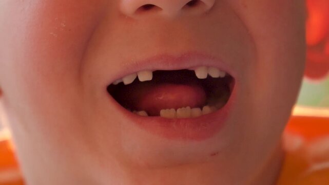 Joyful youthful smile. Smiling young boy displaying playful absence of teeth. Happy child exhibiting gap toothed joyful smile. An energetic young boy proud to showcase his playful gap filled smile