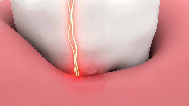 A 3D medical animation illustrating tooth sensitivity and nerve pain, showing electrical pain signals radiating from the inflamed gum line up the tooth's surface