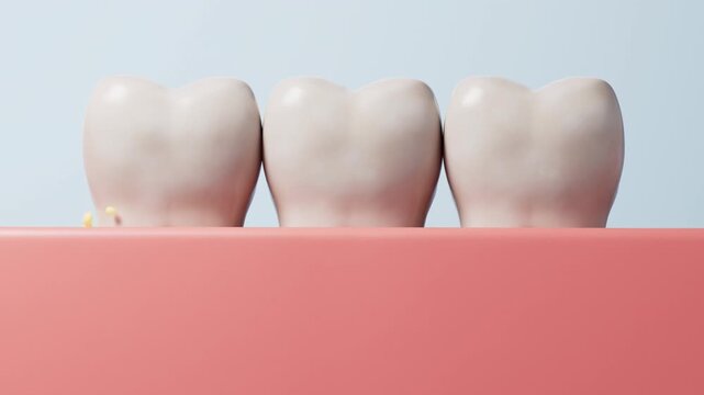 Teeth cleaning animation showing plaque removal from gum line motion graphic