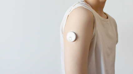 Diabetes Glucose Sensor Attached To Arm Of Young Person At Home. Concept Of Modern Health Monitoring, Medical Wearables, Type 1 Diabetes Management And Smart Technology In Daily Life