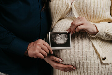 Pregnant girl in knitted clothes in the arms of her beloved husband holding an x-ray of her future child during a photo shoot