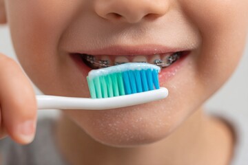 Close-up of happy child with braces brushing teeth. Dental hygiene and orthodontic care concept